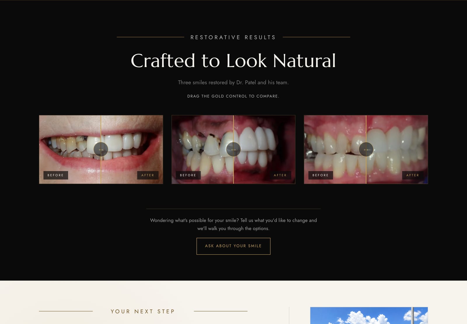 Homepage section titled “Crafted to Look Natural” with three before-and-after comparison sliders of restored smiles.